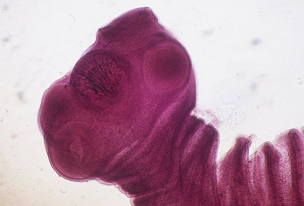 Червь съел мозг кандидату в президенты США. Стали известны подробности о паразите, заразившем соперника Байдена и Трампа