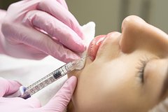 Rossijskaja blogersha pokazala strashnye posledstvija udalenija fillera iz gub 324a701.jpg