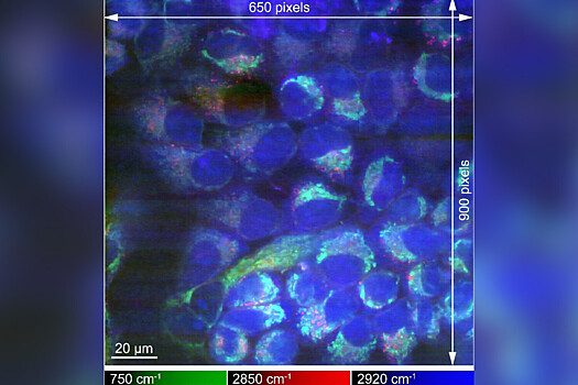 Uchenye poluchili vozmozhnost luchshe razgljadet molekuly b92147f.jpg