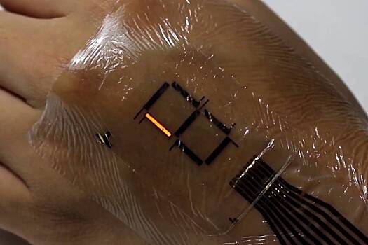 Iskusstvennuju kozhu nauchili vosstanavlivatsja za sekundy 744ec68.jpg