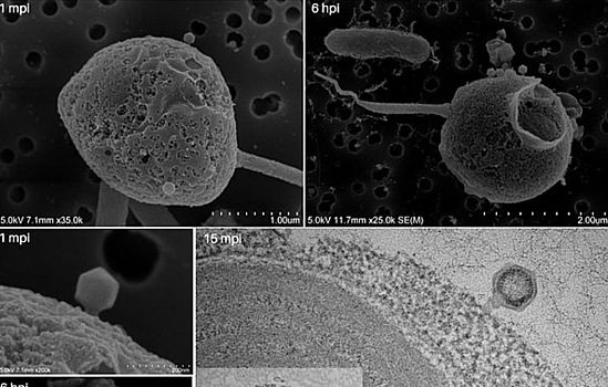 Vpervye obnaruzhen gigantskij virus s neozhidannymi osobennostjami 5da4cd4.jpg